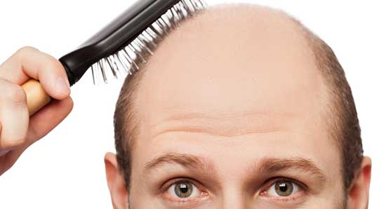 Saç Dökülmesinin 9 nedenine dikkat-Memorial Etiler Tıp Merkezi Dermatoloji Bölümü'nden Uz. Dr. Zerrin Baysal